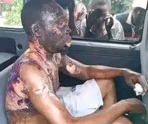 Rivers: Wife Bathes Husband With Hot Oil in Etche