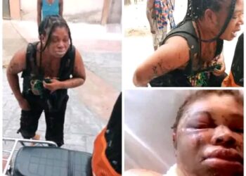 Man Reportedly Bathess Wife With Acid in Rivers