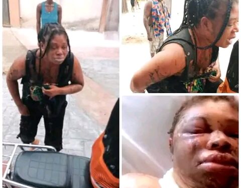 Man Reportedly Bathess Wife With Acid in Rivers