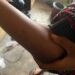 Students of R/S College of Health Sci & Tech Raise Alarm Over Presence of Bedbugs in Mattresses
